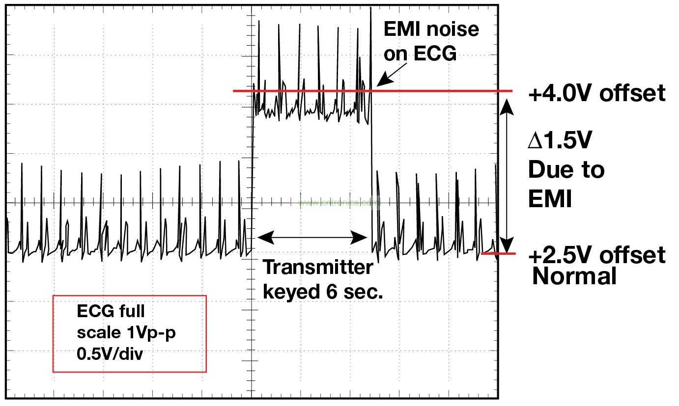 圖 1 1.5 英尺以外的發(fā)射器(f = 470 MHz, P= 0.5W)開啟和關(guān)閉時(shí) ECG 診斷設(shè)備的心臟檢查結(jié)果