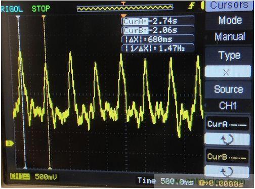 可穿戴技術在醫學領域遍地生花:脈搏血氧計問世
