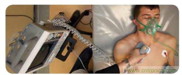 帶電極的醫院用除顫器。注意，患者身上有外部心電圖或心臟監護儀，從胸部的白色圓片(電極)和導聯(線)可看出來。