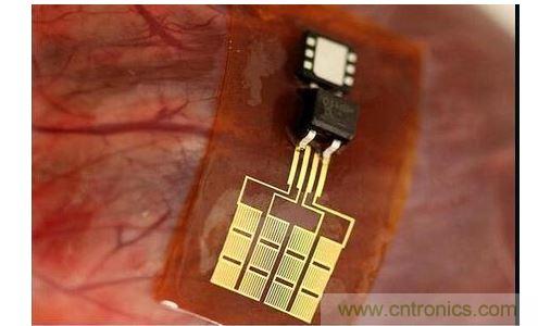 可將人體變成電腦的電子皮膚！