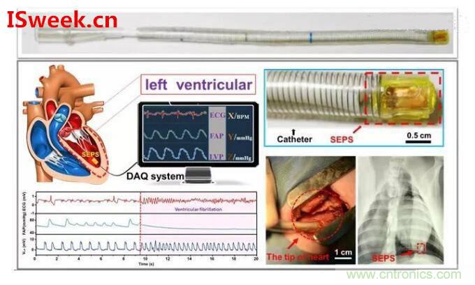 詳解光纖壓力傳感器在心內壓評估的應用 詳解光纖壓力傳感器在心內壓評估的應用