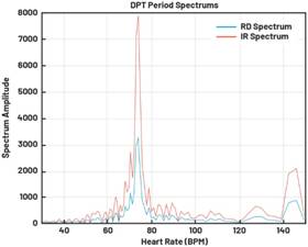 動態離散周期變換技術突破：無ECG參考的生理信號精準解析